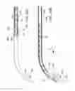 Fig. 25 - Ocular implant delivery system and method