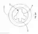 Fig. 30 - Ocular implant delivery system and method
