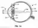 Fig. 02 - Single microstructure lens, systems and methods