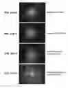 Fig. 28 - Single microstructure lens, systems and methods