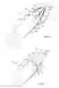Fig. 02 - TYMPANIC MEMBRANE REPAIR DEVICE