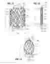 Fig. 08 - Suture deployment of prosthetic heart valve