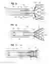 Fig. 09 - Suture deployment of prosthetic heart valve