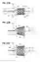 Fig. 16 - Suture deployment of prosthetic heart valve