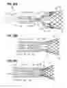 Fig. 19 - Suture deployment of prosthetic heart valve