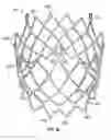 Fig. 23 - Suture deployment of prosthetic heart valve