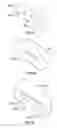 Fig. 29 - Suture deployment of prosthetic heart valve