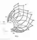 Fig. 33 - Suture deployment of prosthetic heart valve