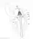 Fig. 01 - Mitral valve inversion prostheses