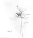 Fig. 06 - Mitral valve inversion prostheses