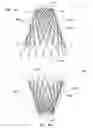 Fig. 11 - Mitral valve inversion prostheses