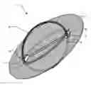 Fig. 01 - Annuloplasty system