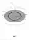 Fig. 03 - Annuloplasty system