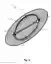 Fig. 07 - Annuloplasty system