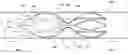 Fig. 01 - Venous valve prostheses