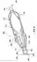 Fig. 08 - Venous valve prostheses