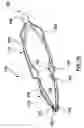 Fig. 09 - Venous valve prostheses