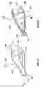 Fig. 10 - Venous valve prostheses