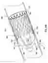 Fig. 15 - Venous valve prostheses