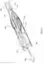 Fig. 17 - Venous valve prostheses