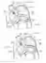 Fig. 06 - Devices, systems, and methods for reshaping a heart valve annulus