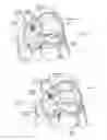 Fig. 11 - Devices, systems, and methods for reshaping a heart valve annulus
