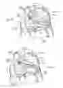 Fig. 13 - Devices, systems, and methods for reshaping a heart valve annulus