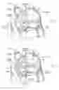 Fig. 15 - Devices, systems, and methods for reshaping a heart valve annulus