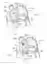 Fig. 17 - Devices, systems, and methods for reshaping a heart valve annulus