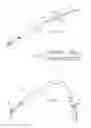 Fig. 22 - Devices, systems, and methods for reshaping a heart valve annulus