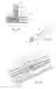 Fig. 26 - Devices, systems, and methods for reshaping a heart valve annulus