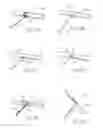 Fig. 29 - Devices, systems, and methods for reshaping a heart valve annulus