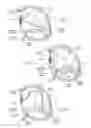 Fig. 33 - Devices, systems, and methods for reshaping a heart valve annulus