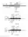 Fig. 13 - Treating dysfunctional cardiac tissue