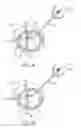 Fig. 20 - Treating dysfunctional cardiac tissue