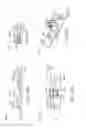 Fig. 27 - Treating dysfunctional cardiac tissue