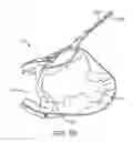Fig. 35 - Treating dysfunctional cardiac tissue