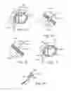 Fig. 51 - Treating dysfunctional cardiac tissue