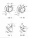 Fig. 52 - Treating dysfunctional cardiac tissue