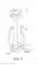 Fig. 02 - Universal valve annulus sizing device