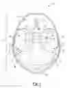 Fig. 02 - Tegmen plate prosthesis and methods for manufacturing and using the same