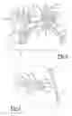 Fig. 03 - Tegmen plate prosthesis and methods for manufacturing and using the same