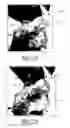 Fig. 10 - Tegmen plate prosthesis and methods for manufacturing and using the same