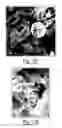 Fig. 12 - Tegmen plate prosthesis and methods for manufacturing and using the same