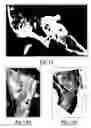 Fig. 13 - Tegmen plate prosthesis and methods for manufacturing and using the same