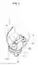Fig. 02 - Artificial knee joint
