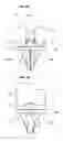 Fig. 04 - Artificial knee joint
