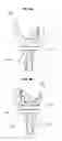Fig. 05 - Artificial knee joint