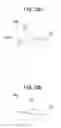 Fig. 14 - Artificial knee joint