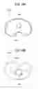 Fig. 16 - Artificial knee joint